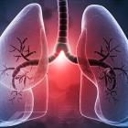 آسیبزایی نانوالیافها بیشتر به شکل آنها وابسته است تا ترکیب شیمیایی